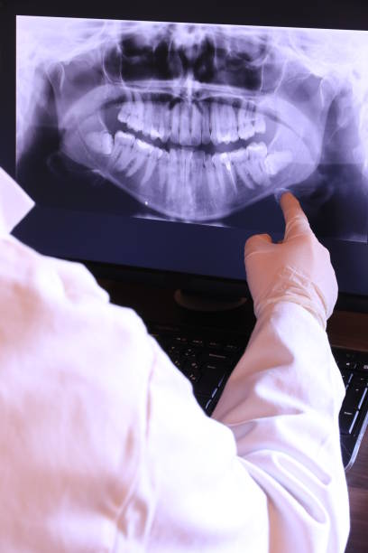 Best Emergency Dental Care for Abscessed Tooth in Crestline, OH