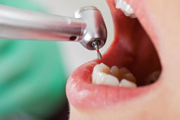 Best Weekend Emergency Dentist in Crestline, OH